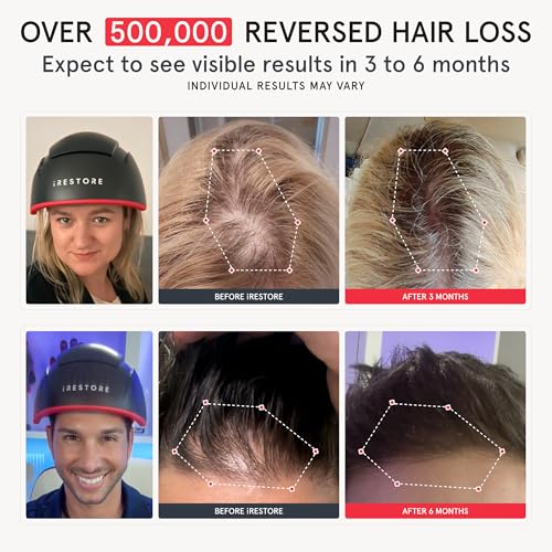 Elite Laser Hair Growth System W178